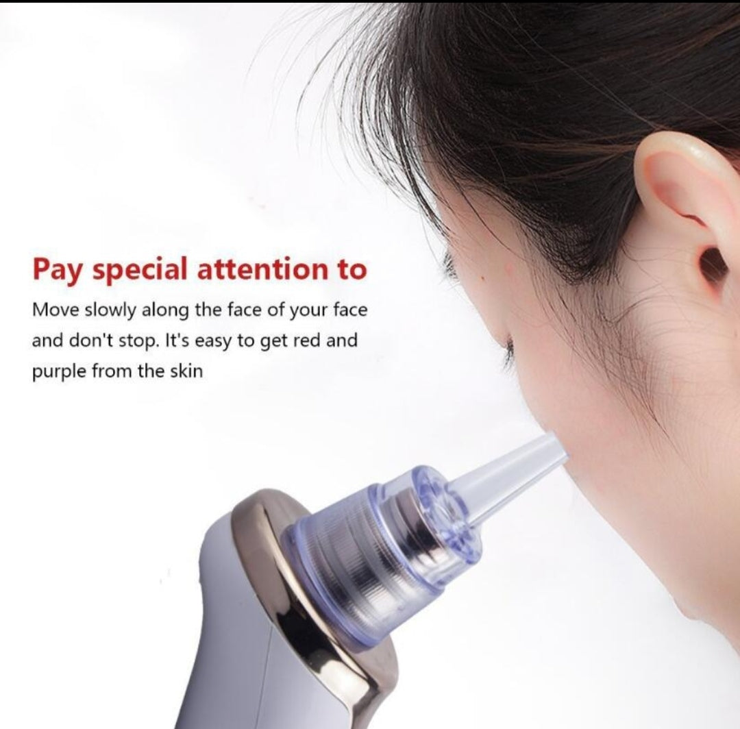 Smart Blackhead Suction Cleaner