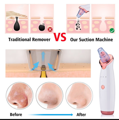 Smart Blackhead Suction Cleaner