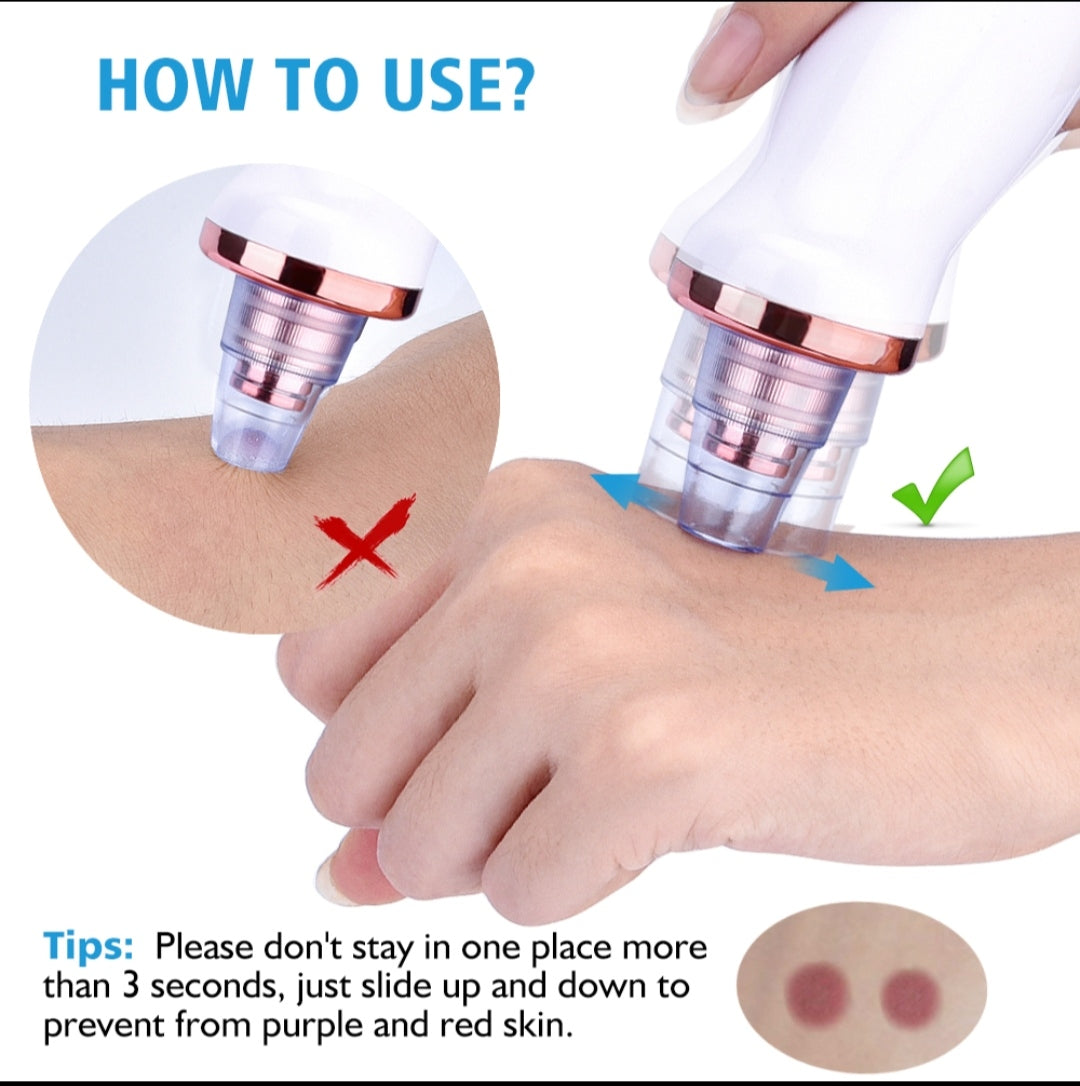 Smart Blackhead Suction Cleaner